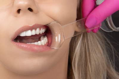 Rozwierak dwustronny 2 szt. COTISEN - L