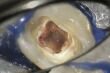 Náhled 2