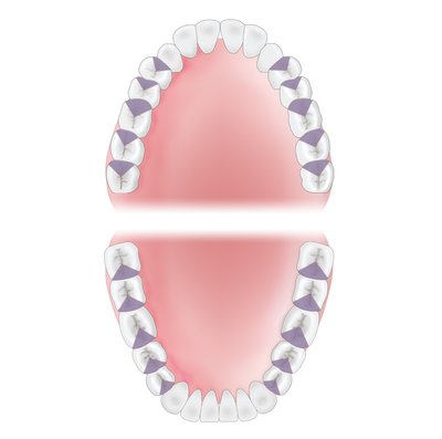 Gracey 11 XP-AEG11XPQT