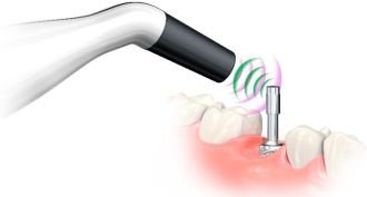 Hiossen IS3 MulTipeg 29 ET System Standard