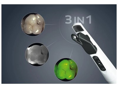 KaVo - DIAGNOcam Vision Full HD