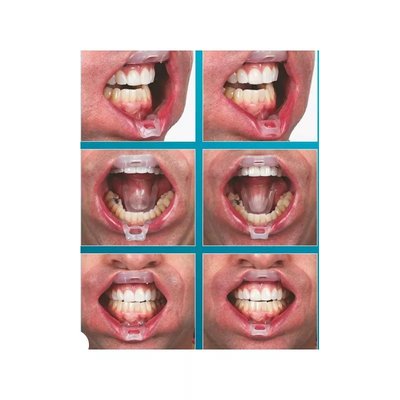 Umbrella Large- retraktor do ust, policzków i języka 5szt UP 5256