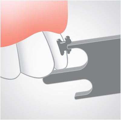 Medesy 4876 - Meradlá výšky bracketov