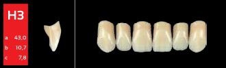 Ref-Line Anterior A4 H3