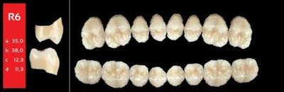 Ref-Line Posterior A4 R6 dolní zuby