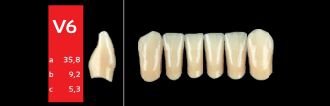 Ref-Line Anterior A2 V6