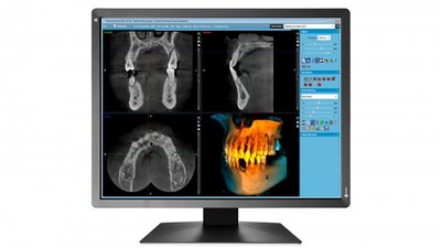 EIZO MX217-SB RadiForce (RK 5)