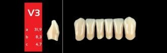 Ref-Line Anterior D3 V3 zuby
