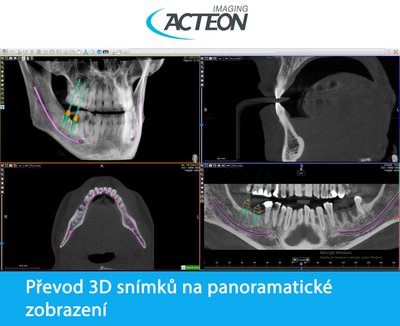 CBCT 3D kombinace 2D a 3D zobrazení