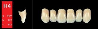 Ref-Line Anterior A3,5 H4