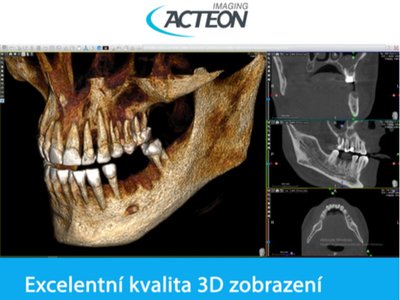 CBCT 3D kvalita zobrazení