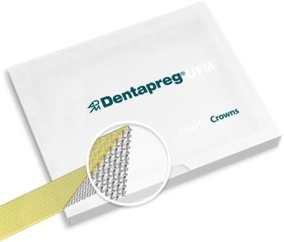 Dentapreg UFM Crowns