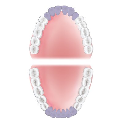 Gracey 6 XP-AEG6XPQT