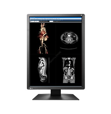 Monitor EIZO 21 RadiForce MX216HB-BK 4:3 - z kalibracją i testami