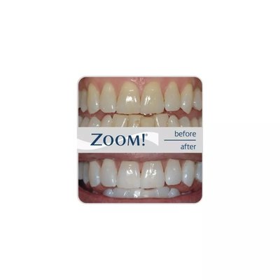 System do wybielania Philips Zoom WhiteSpeed