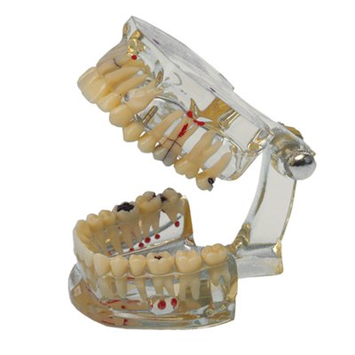 Studijní model Transparent Plus - 1 ks