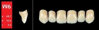 Ref-Line Anterior A3,5 W6