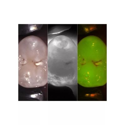 KaVo DIAGNOcam - laserowa kamera diagnostyczna