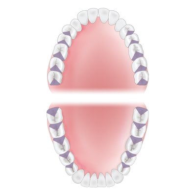 Gracey 18 XP-AEG18XPQT