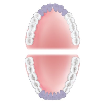 Gracey 1 XP-AEG1XPQT