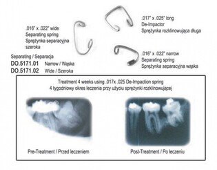 Sprężynki separacyjne szerokie NiTi MaxiFlex 2szt/opak. DO.5171.02