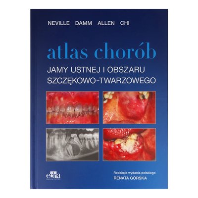 Edra Urban & Partner - Atlas chorób jamy ustnej