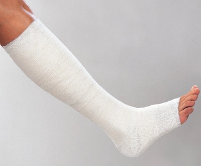 Obinadlo zinkoklihové stretch Varicex S 10 cm x 5 m, 1 ks