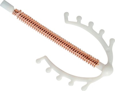 Nitroděložní tělísko Pregna Inara Cu 375