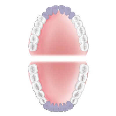 Gracey 4 XP-AEG4XPQT