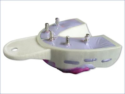 Miratray implant lžíce sada 6 ks