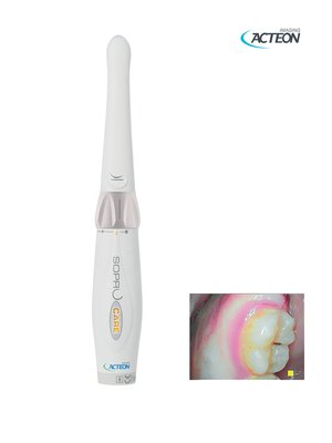 Intraorální kamera Acteon Satelec SOPROCARE - Diagnostická kamera pro vyhledávání kazu a plaku