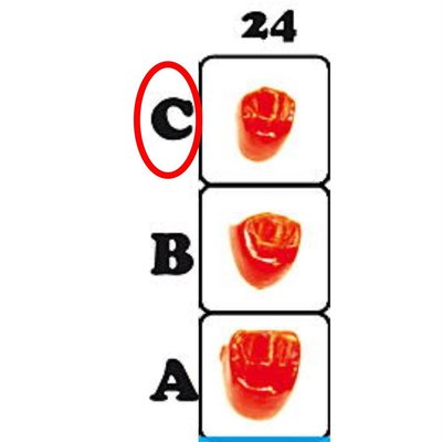 Náhled 2