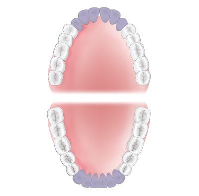 Gracey 3 XP-AEG3XPQT
