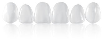 xxxComponeer Upper S 12 - Enamel White Opalescent