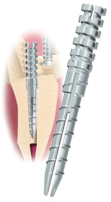 Flexi Post titan 10+1 - WARIANTY