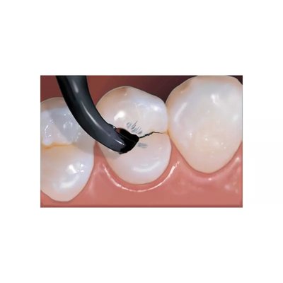 Sable Seek Mini Kit wykrywacz próchnicy 2strz. x 1,2ml UP 1021