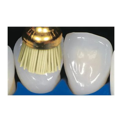 Szczotka Occlubrush Ass Kit (5x kielich, 5xmały kielich, 5xstożek)