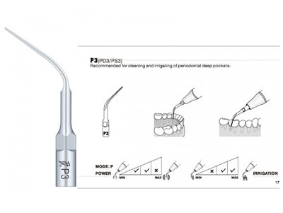 WOODPECKER P3 - Parodontologie