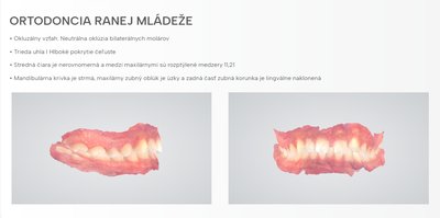 Náhled 11