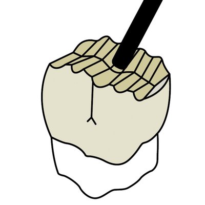 Náhled 3