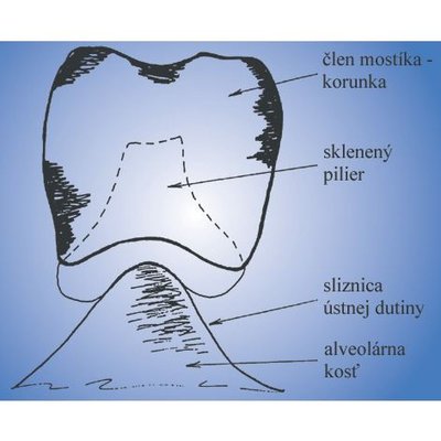 Náhled 3
