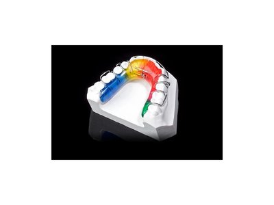 SHERA - Shera KFO-GIPS