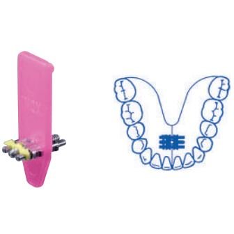 Šroub univerzální 10 mm 10 ks