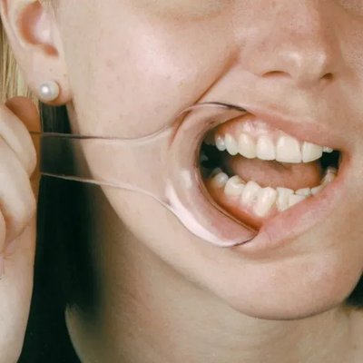 Mirahold rozvěrač 2ks, normal