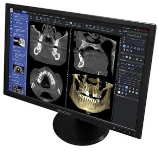 Monitor Medyczny BEACON HL2416SH