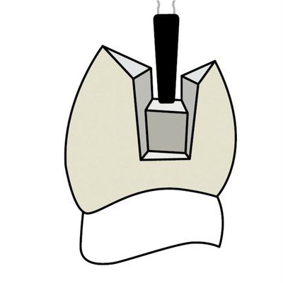 Náhled 5