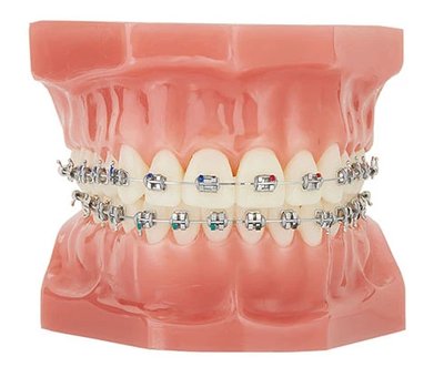 Zamki metalowe Atlas mini Roth z haczykiem - WARIANTY