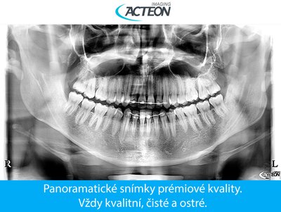 Panoramatické zobrazení 1