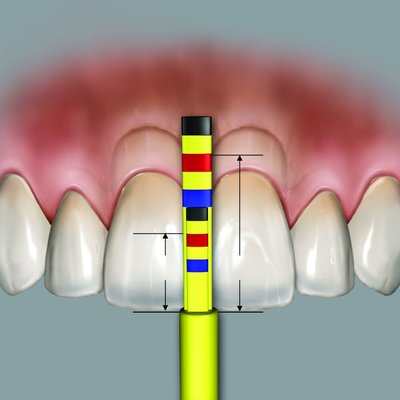 Chu Gauges PAPILLA refill tips 3pcs./pack.