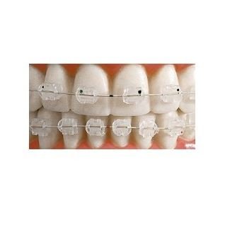 Estetické zámky NATURA Roth horní/dolní bez háčku 5-5 slot .018 1 sada (20 ks)